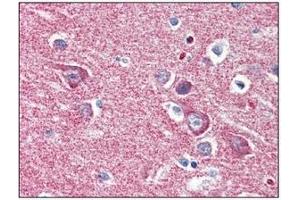 Immunohistochemistry (IHC) image for anti-Hexokinase 1 (HK1) (AA 1-917), (N-Term) antibody (ABIN317095)