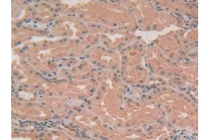 Detection of ACTa2 in Human Stomach Tissue using Polyclonal Antibody to Actin Alpha 2, Smooth Muscle (ACTa2)