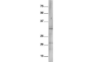 Mouse spleen lysates probed with Anti-Bcl-2 (Ser70) Polyclonal Antibody, Unconjugated  at 1:5000 90min in 37˚C (Bcl-2 anticorps  (pSer70))
