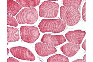Anti-FBXO32 / MAFBX / Atrogin 1 antibody IHC staining of human skeletal muscle.