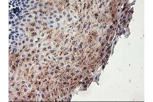 Immunohistochemical staining of paraffin-embedded Human tonsil using anti-ACSS2 mouse monoclonal antibody. (ACSS2 anticorps)