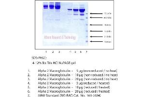Gel Scan of Alpha 2 Macroglobulin, Human Plasma  This information is representative of the product ART prepares, but is not lot specific.