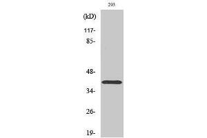 Western Blotting (WB) image for anti-ATPase, Na+/K+ Transporting, beta 3 Polypeptide (ATP1B3) (Internal Region) antibody (ABIN6284532)