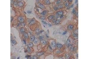 IHC-P analysis of Human Tissue, with DAB staining. (Neuregulin 1 anticorps  (AA 20-242))