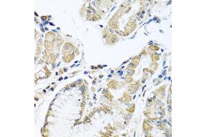 Immunohistochemistry of paraffin-embedded human stomach using IFNL3 antibody at dilution of 1:100 (40x lens). (IL28B anticorps)