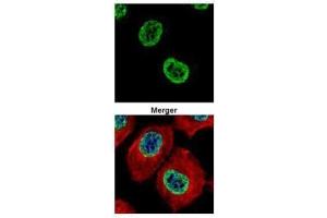 ICC/IF Image Confocal immunofluorescence analysis (Olympus FV10i) of paraformaldehyde-fixed A431, using Histone H2A. (H2AFZ anticorps  (N-Term))