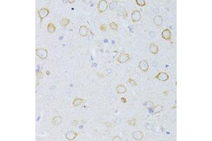 Immunohistochemistry of paraffin-embedded rat brain using CD63 antibody (ABIN5974980) at dilution of 1/100 (40x lens). (CD63 anticorps)
