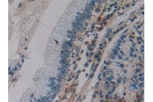 Detection of F13A1 in Human Esophagus Tissue using Polyclonal Antibody to Coagulation Factor XIII A1 Polypeptide (F13A1)