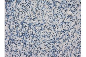 Immunohistochemical staining of paraffin-embedded colon tissue using anti-FCGR2A mouse monoclonal antibody. (FCGR2A anticorps)