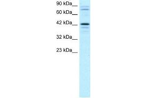 Human Jurkat; WB Suggested Anti-SOX18 Antibody Titration: 2. (SOX18 anticorps  (Middle Region))