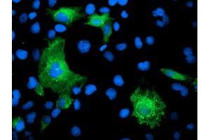 Anti-KATNB1 mouse monoclonal antibody (ABIN2455206) immunofluorescent staining of COS7 cells transiently transfected by pCMV6-ENTRY KATNB1 (RC201852). (KATNB1 anticorps)