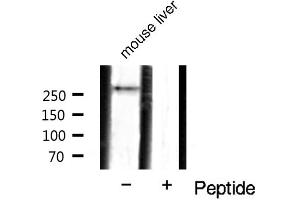 Western blot analysis of mTOR phosphorylation expression in mouse liver tissue lysates,The lane on the right is treated with the antigen-specific peptide. (MTOR anticorps  (pSer2448))