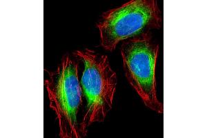 Immunofluorescent analysis of 4 % paraformaldehyde-fixed, 0.