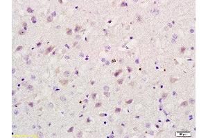 Formalin-fixed and paraffin embedded rat brain labeled with Rabbit Anti RBBP5 Polyclonal Antibody, Unconjugated  at 1:200 followed by conjugation to the secondary antibody and DAB staining (RBBP5 anticorps  (AA 131-230))