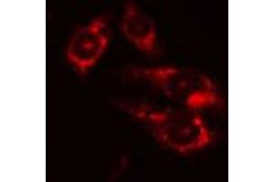 ABIN6274207 staining Hela cells by IF/ICC. (DTYMK anticorps  (Internal Region))