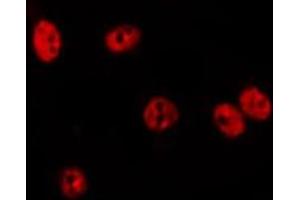 ABIN6275631 staining HepG2 by IF/ICC.