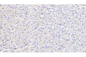 Detection of IFNg in Canine Liver Tissue using Polyclonal Antibody to Interferon Gamma (IFNg)