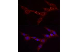 Immunofluorescence analysis of NIH/3T3 cells using Bcdin3d Rabbit pAb (ABIN7265842) at dilution of 1:25 (40x lens).