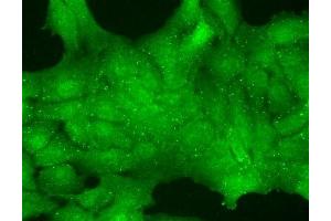 Immunocytochemistry/Immunofluorescence analysis using Mouse Anti-TrpC7 Monoclonal Antibody, Clone N64A/36 (ABIN2485430).