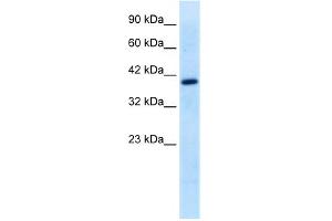 WB Suggested Anti-TFEB Antibody Titration:  0. (TFEB anticorps  (Middle Region))