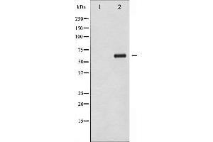 Western blot analysis of Chk2 phosphorylation expression in UV treated COS7 whole cell lysates,The lane on the left is treated with the antigen-specific peptide.