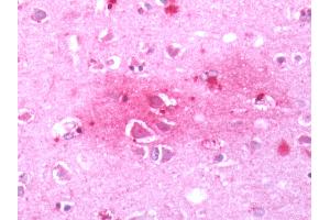 Human Brain, Cortex: Formalin-Fixed, Paraffin-Embedded (FFPE)