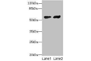 Western blot All lanes: CYP17A1 antibody at 12 μg/mL Lane 1: Hela whole cell lysate Lane 2: A549 whole cell lysate Secondary Goat polyclonal to rabbit IgG at 1/10000 dilution Predicted band size: 58 kDa Observed band size: 58 kDa
