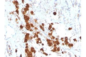 Formalin-fixed, paraffin-embedded human Pituitary stained with ACTH Monoclonal Antibody (SPM333). (POMC anticorps  (AA 1-24))