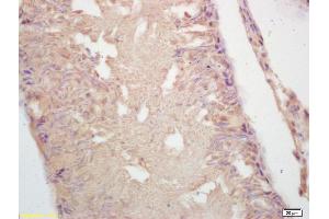 Formalin-fixed and paraffin embedded rat testis labeled with Rabbit Anti GAD65 Polyclonal Antibody, Unconjugated (ABIN668140) at 1:200 followed by conjugation to the secondary antibody and DAB staining