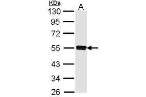 WB Image Sample (30 ug of whole cell lysate) A: Molt-4 , 10% SDS PAGE antibody diluted at 1:1000 (TRIM21 anticorps)