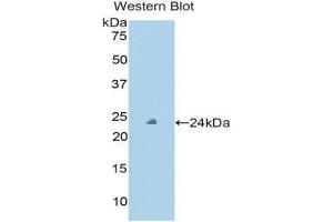 Western Blotting (WB) image for anti-Peroxidasin Homolog (PXDN) (AA 76-260) antibody (ABIN1860379) (Peroxidasin anticorps  (AA 76-260))