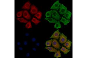 ABIN6257947 and ABIN6275876 staining Hela cells by IF/ICC. (BTLA anticorps  (C-Term))