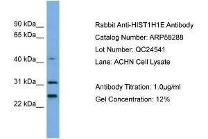 WB Suggested Anti-HIST1H1E  Antibody Titration: 0.