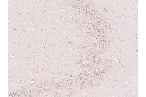 Paraformaldehyde-fixed, paraffin embedded Rat brain Antigen retrieval by boiling in sodium citrate buffer (pH6.