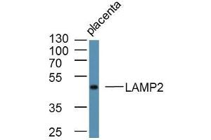 Mouse placenta lysates probed with LAMP2 Polyclonal Antibody, Unconjugated  at 1:300 overnight at 4˚C.