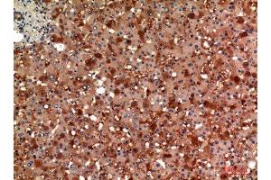 Immunohistochemistry (IHC) analysis of paraffin-embedded Human Liver, antibody was diluted at 1:100.