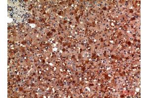 Immunohistochemistry (IHC) analysis of paraffin-embedded Human Liver, antibody was diluted at 1:100. (AGT anticorps  (Internal Region))
