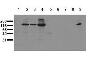 Western Blotting (WB) image for anti-Cadherin 2 (CDH2) antibody (ABIN126737) (N-Cadherin anticorps)