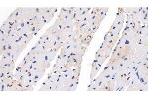 Detection of SEMA5B in Mouse Cardiac Muscle Tissue using Polyclonal Antibody to Semaphorin 5B (SEMA5B)