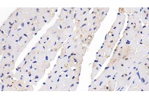 Detection of SEMA5B in Mouse Cardiac Muscle Tissue using Polyclonal Antibody to Semaphorin 5B (SEMA5B) (SEMA5B anticorps  (AA 836-1013))