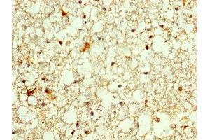 IHC image of ABIN7155839 diluted at 1:250 and staining in paraffin-embedded human brain tissue performed on a Leica BondTM system. (OTX2 anticorps  (AA 1-297))