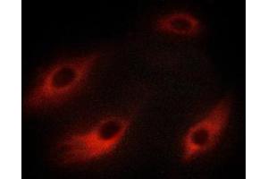 ABIN6267220 staining HeLa cells by ICC/IF.