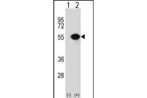 Western blot analysis of RUVBL1 (arrow) using rabbit polyclonal RUVBL1 Antibody (ABIN650671 and ABIN2838241).