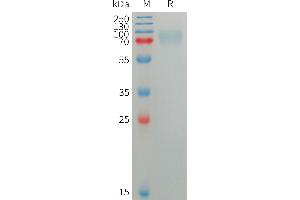 Human SIG Protein, His Tag on SDS-PAGE under reducing condition.