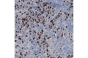 Immunohistochemical staining of human spleen with OTOA polyclonal antibody  shows strong cytoplasmic positivity in cells of red pulp at 1:50-1:200 dilution. (OTOA anticorps)