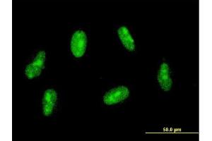 Immunofluorescence of monoclonal antibody to SAP30 on HeLa cell.