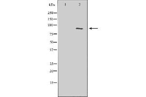 Western blot analysis of extracts of COLO 320, using ERCC3 antibody.