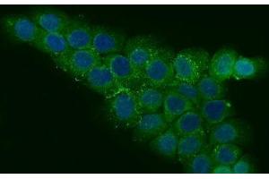 IF analysis of CCDC115 using anti-CCDC115 antibody (ABIN7599042). (CCDC115 anticorps  (AA 1-180))