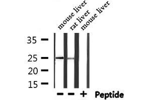 Western blot analysis of extracts from mouse liver,rat liver, using FTL Antibody.