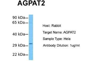 Host:  Rabbit  Target Name:  AGPAT2  Sample Tissue:  Human Hela  Antibody Dilution:  1.